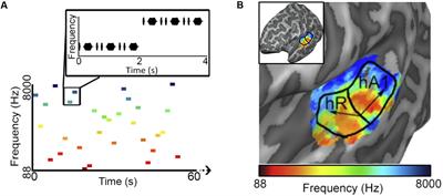 Reconstructing Tone Sequences from Functional Magnetic Resonance Imaging Blood-Oxygen Level Dependent Responses within Human Primary Auditory Cortex